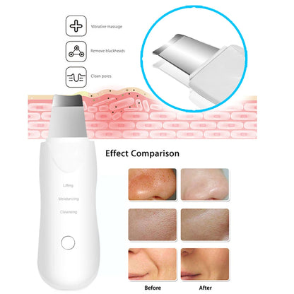 Ultrasonic Deep Cleansing Facial Cleaner