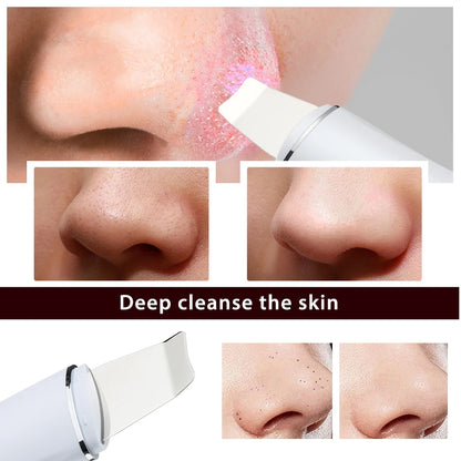 Ultrasonic Skin Scrubber Deep Face Cleaning Machine 4 Modes Peeling Shovel Facial Pore Cleaner Face Skin Scrubber Lift Machine